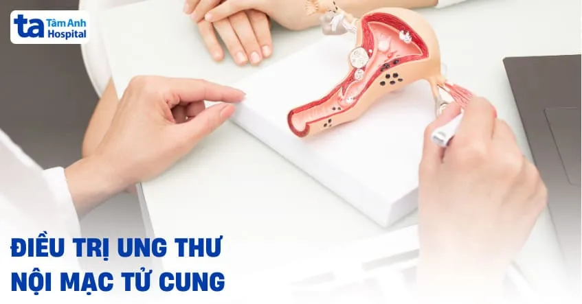 Cách điều trị ung thư nội mạc tử cung phổ biến hiện nay