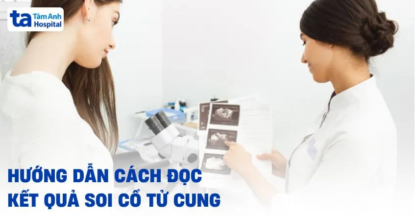 Hướng dẫn cách đọc kết quả soi cổ tử cung chính xác và dễ dàng