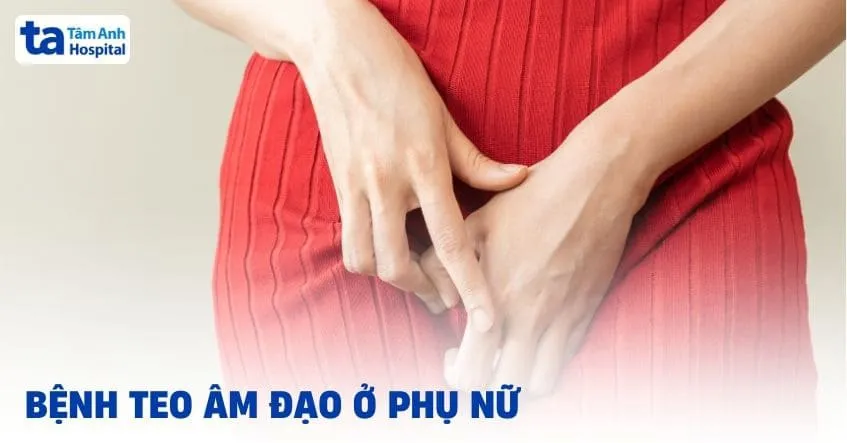 Viêm teo âm đạo là gì? Nguyên nhân, dấu hiệu, chẩn đoán
